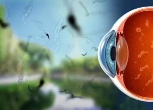 Simulación de síntomas de desprendimiento de retina, sobre paisaje del Parque de Mayo en San Juan.